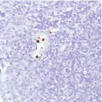 Immunohistochemistry (Formalin/PFA-fixed paraffin-embedded sections) - Anti-Neutrophil Elastase antibody [SP203] - BSA and Azide free (AB243923)