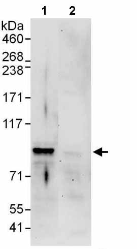 Immunoprecipitation - Anti-Nexilin/F-actin-binding protein antibody (AB140435), expandable thumbnail