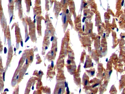 Immunohistochemistry (Formalin/PFA-fixed paraffin-embedded sections) - Anti-Nexilin/F-actin-binding protein antibody (AB233235)