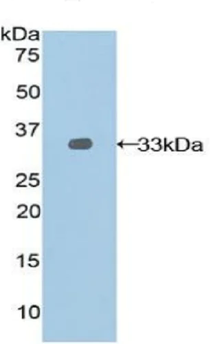 Western blot - Anti-Nexilin/F-actin-binding protein antibody (AB233235)