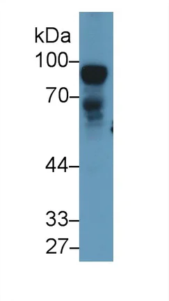 Western blot - Anti-Nexilin/F-actin-binding protein antibody (AB233235)