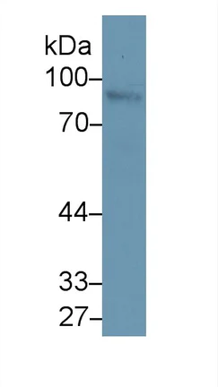 Western blot - Anti-Nexilin/F-actin-binding protein antibody (AB233235)
