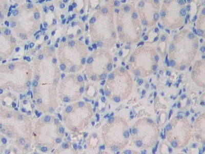 Immunohistochemistry (Formalin/PFA-fixed paraffin-embedded sections) - Anti-Nexilin/F-actin-binding protein antibody (AB233267)