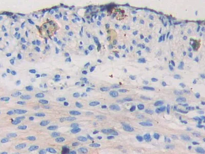 Immunohistochemistry (Formalin/PFA-fixed paraffin-embedded sections) - Anti-Nexilin/F-actin-binding protein antibody (AB233267)