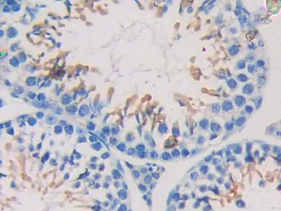 Immunohistochemistry (Formalin/PFA-fixed paraffin-embedded sections) - Anti-Nexilin/F-actin-binding protein antibody (AB233267)