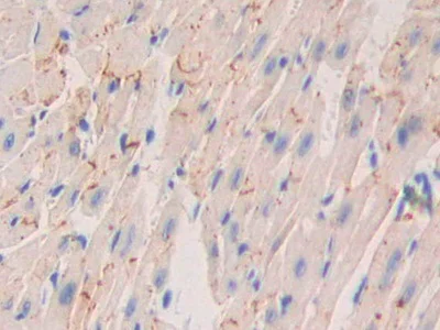 Immunohistochemistry (Formalin/PFA-fixed paraffin-embedded sections) - Anti-Nexilin/F-actin-binding protein antibody (AB233267)