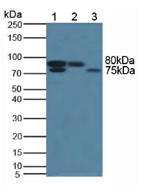 Western blot - Anti-Nexilin/F-actin-binding protein antibody (AB233267)