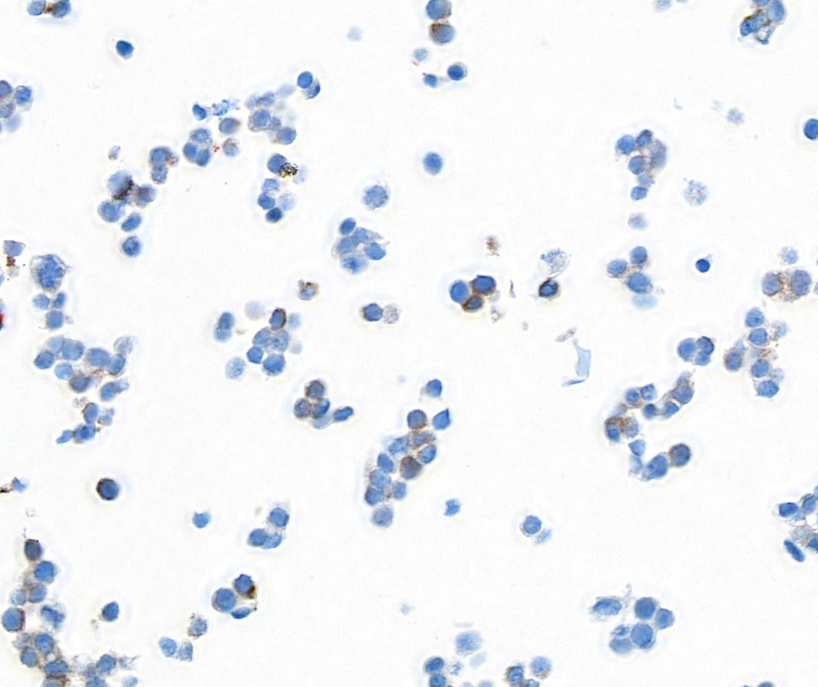 Immunocytochemistry - Anti-NF-H antibody [BLR189J] - BSA free (AB314077), expandable thumbnail
