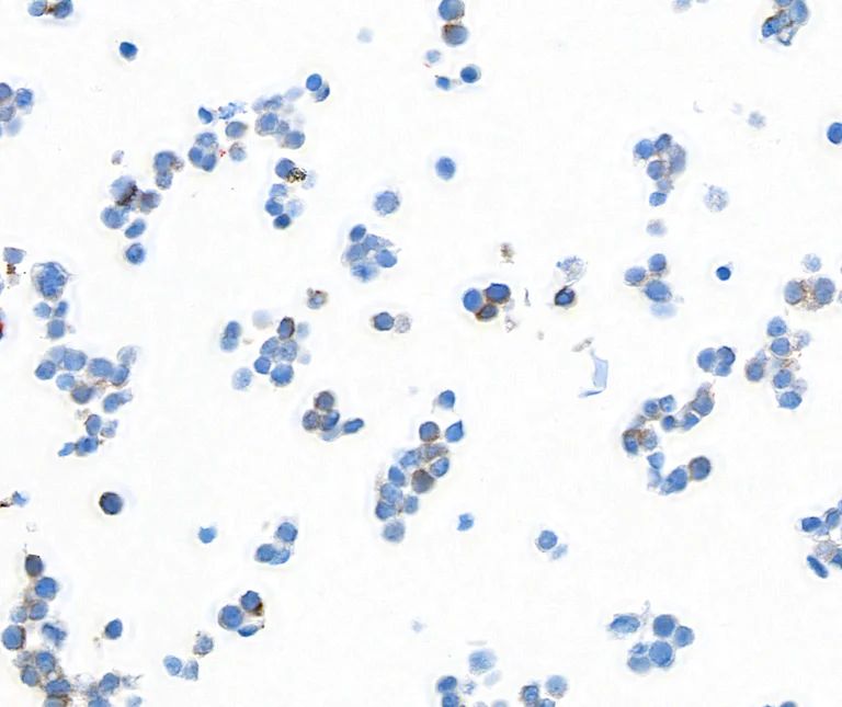 Immunocytochemistry - Anti-NF-H antibody [BLR189J] - BSA free (AB314077)