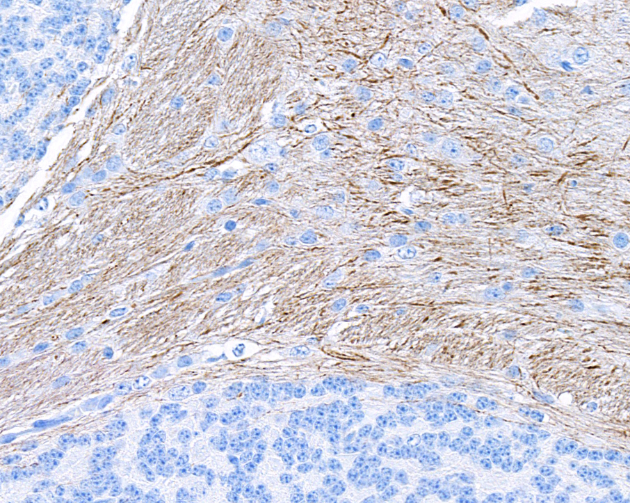 Immunohistochemistry (Formalin/PFA-fixed paraffin-embedded sections) - Anti-NF-H antibody [BLR189J] - BSA free (AB314077), expandable thumbnail