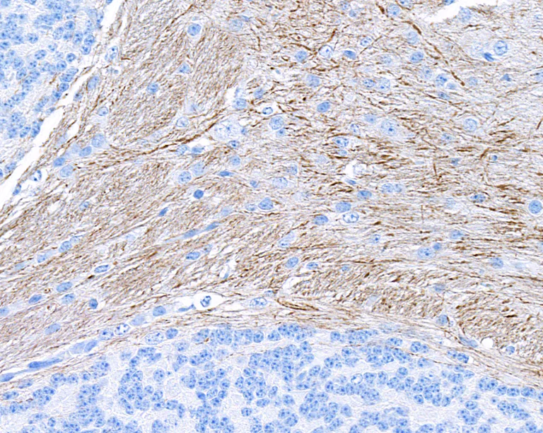 Immunohistochemistry (Formalin/PFA-fixed paraffin-embedded sections) - Anti-NF-H antibody [BLR189J] - BSA free (AB314077)