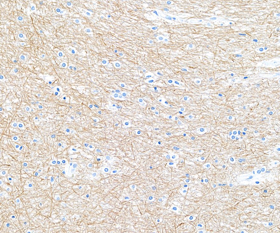 Immunohistochemistry (Formalin/PFA-fixed paraffin-embedded sections) - Anti-NF-H antibody [BLR189J] - BSA free (AB314077), expandable thumbnail