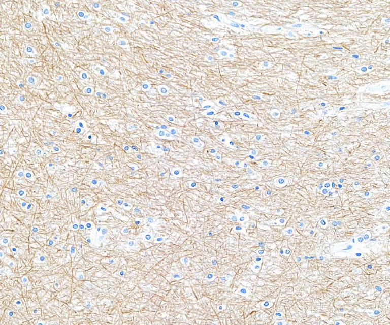 Immunohistochemistry (Formalin/PFA-fixed paraffin-embedded sections) - Anti-NF-H antibody [BLR189J] - BSA free (AB314077)