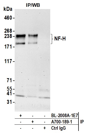 Immunoprecipitation - Anti-NF-H antibody [BLR189J] - BSA free (AB314077), expandable thumbnail