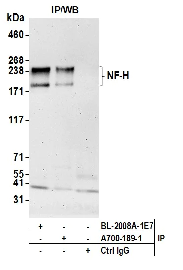 Immunoprecipitation - Anti-NF-H antibody [BLR189J] - BSA free (AB314077)