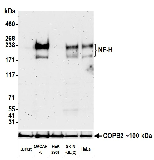 Western blot - Anti-NF-H antibody [BLR189J] - BSA free (AB314077)