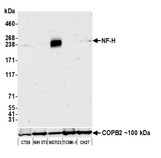 Western blot - Anti-NF-H antibody [BLR189J] - BSA free (AB314077), expandable thumbnail