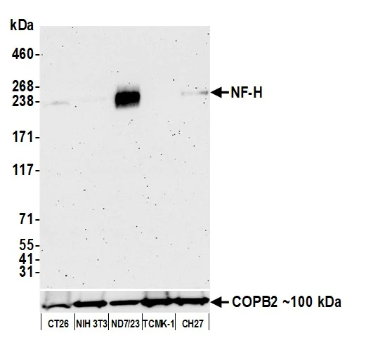 Western blot - Anti-NF-H antibody [BLR189J] - BSA free (AB314077)