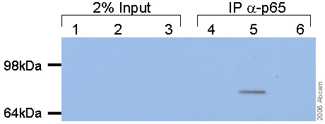 Immunoprecipitation - Anti-NF-kB p65 (acetyl K310) antibody (AB19870), expandable thumbnail