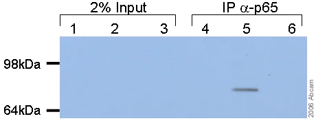 Immunoprecipitation - Anti-NF-kB p65 (acetyl K310) antibody (AB19870)