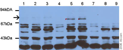 Western blot - Anti-NF-kB p65 (acetyl K310) antibody (AB19870)