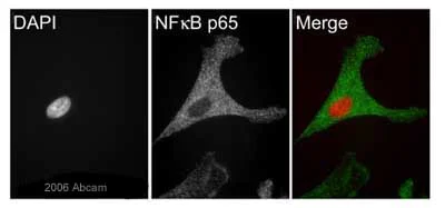 Immunocytochemistry/ Immunofluorescence - Anti-NF-kB p65 antibody (AB16502)