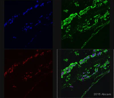 Immunohistochemistry (Formalin/PFA-fixed paraffin-embedded sections) - Anti-NF-kB p65 antibody (AB16502)