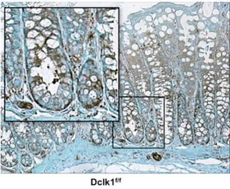 Immunohistochemistry (Formalin/PFA-fixed paraffin-embedded sections) - Anti-NF-kB p65 antibody (AB16502)