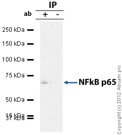 Immunoprecipitation - Anti-NF-kB p65 antibody (AB16502)