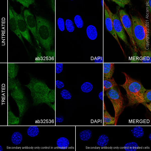 Immunocytochemistry/ Immunofluorescence - Anti-NF-kB p65 antibody [E379] (AB32536)