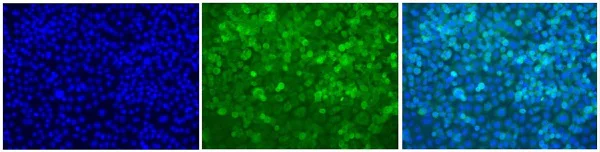 Immunocytochemistry/ Immunofluorescence - Anti-NF-kB p65 antibody [E379] (AB32536)