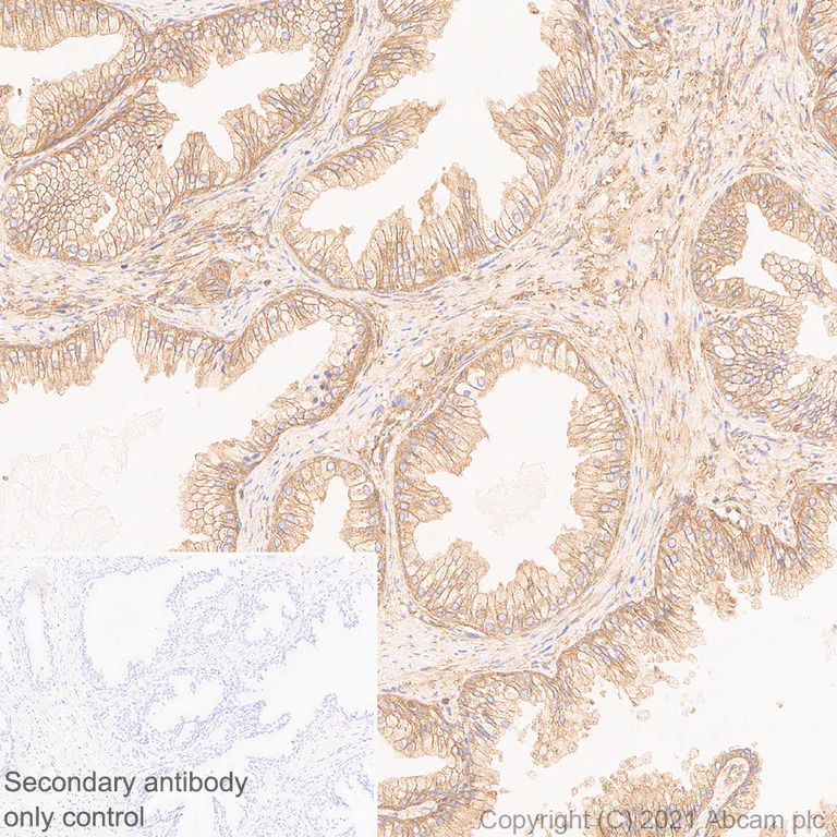 Immunohistochemistry (Formalin/PFA-fixed paraffin-embedded sections) - Anti-NF-kB p65 antibody [E379] (AB32536)