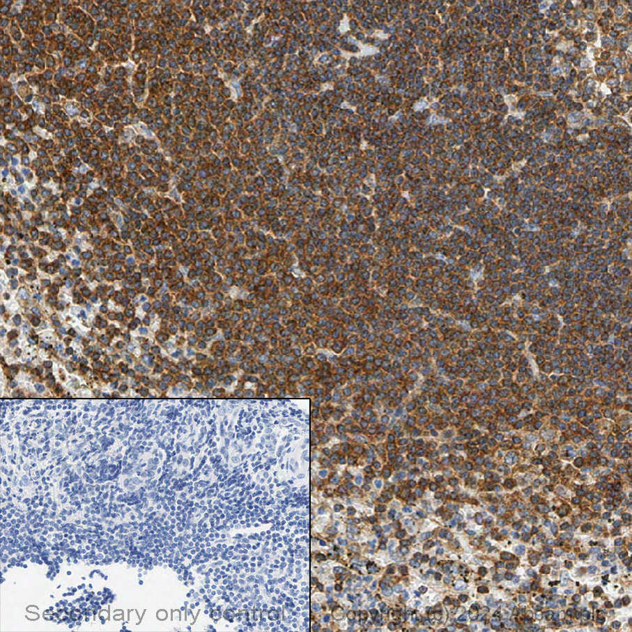 Immunohistochemistry (Formalin/PFA-fixed paraffin-embedded sections) - Anti-NF-kB p65 antibody [E379] (ab32536), expandable thumbnail
