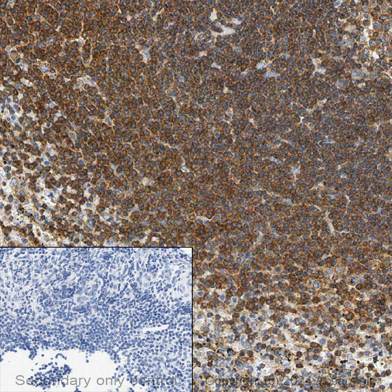 Immunohistochemistry (Formalin/PFA-fixed paraffin-embedded sections) - Anti-NF-kB p65 antibody [E379] (AB32536)