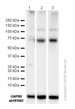 Western blot - Anti-NF-kB p65 antibody [E379] (AB32536)