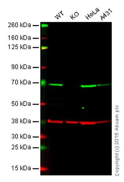 Western blot - Anti-NF-kB p65 antibody [E379] (AB32536)