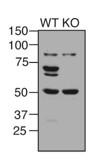 Western blot - Anti-NF-kB p65 antibody [E379] (AB32536)