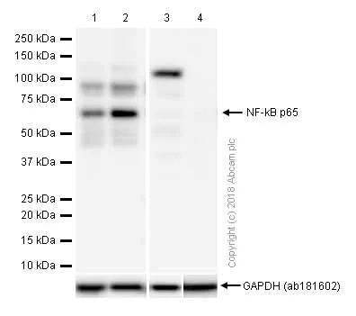 Western blot - Anti-NF-kB p65 antibody [E379] (AB32536)