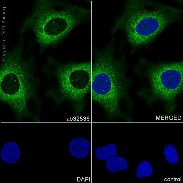 Immunocytochemistry/ Immunofluorescence - Anti-NF-kB p65 antibody [E379] - BSA and Azide free (AB207297)