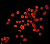 Immunocytochemistry/ Immunofluorescence - Anti-NF-kB p65 antibody [E379] - BSA and Azide free (AB207297)