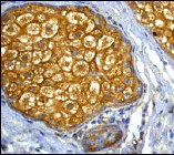 Immunohistochemistry (Formalin/PFA-fixed paraffin-embedded sections) - Anti-NF-kB p65 antibody [E379] - BSA and Azide free (AB207297)
