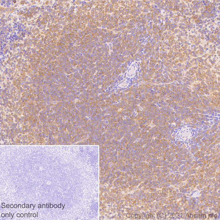 Immunohistochemistry (Formalin/PFA-fixed paraffin-embedded sections) - Anti-NF-kB p65 antibody [E379] - BSA and Azide free (AB207297)