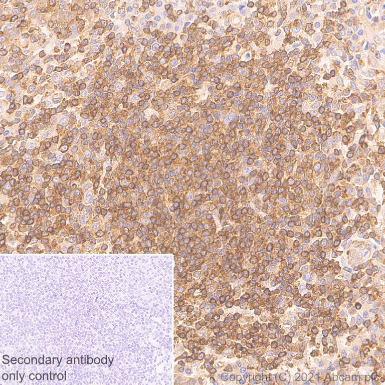 Immunohistochemistry (Formalin/PFA-fixed paraffin-embedded sections) - Anti-NF-kB p65 antibody [E379] - BSA and Azide free (AB207297)