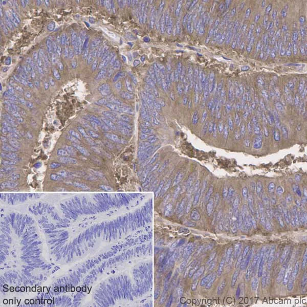 Immunohistochemistry (Formalin/PFA-fixed paraffin-embedded sections) - Anti-NF-kB p65 antibody [E379] - BSA and Azide free (AB207297)