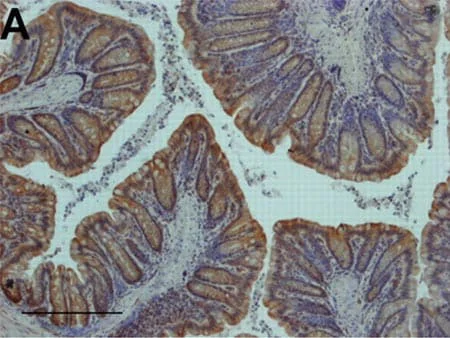 Immunohistochemistry (Formalin/PFA-fixed paraffin-embedded sections) - Anti-NF-kB p65 antibody [E379] - BSA and Azide free (AB207297)