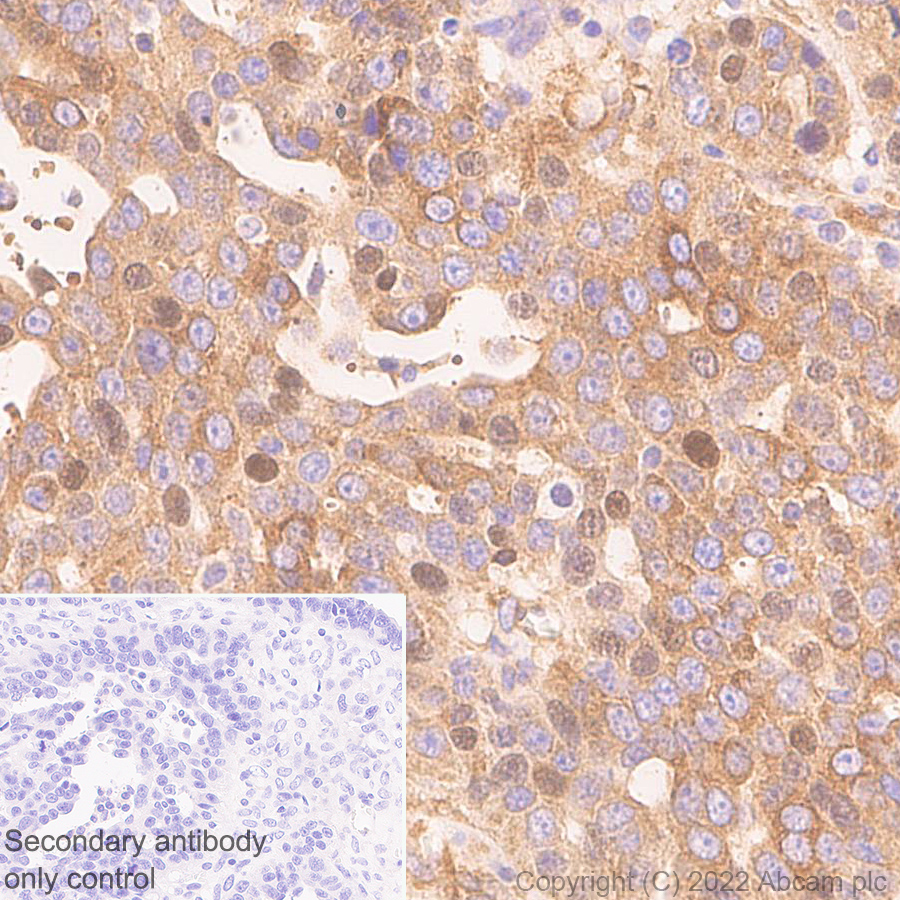 Immunohistochemistry (Formalin/PFA-fixed paraffin-embedded sections) - Anti-NF-kB p65 antibody [E379] - Mouse IgG2a (Chimeric) (AB307840), expandable thumbnail