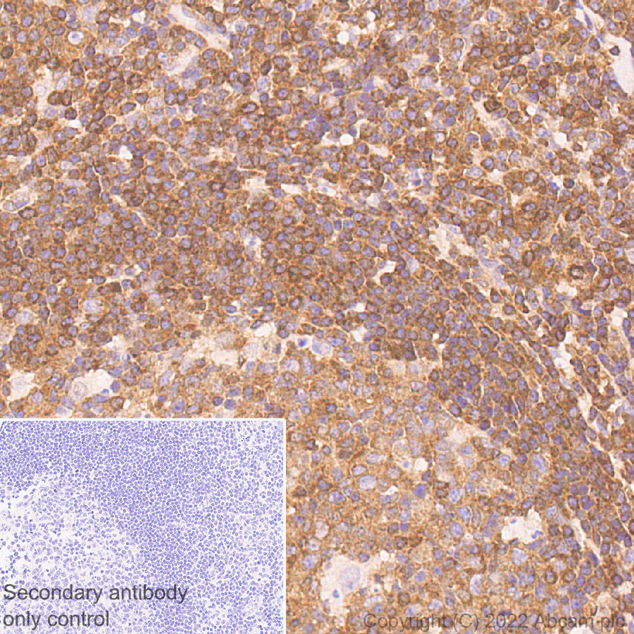 Immunohistochemistry (Formalin/PFA-fixed paraffin-embedded sections) - Anti-NF-kB p65 antibody [E379] - Mouse IgG2a (Chimeric) (AB307840), expandable thumbnail