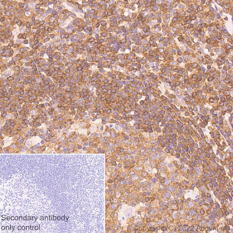 Immunohistochemistry (Formalin/PFA-fixed paraffin-embedded sections) - Anti-NF-kB p65 antibody [E379] - Mouse IgG2a (Chimeric) - BSA and Azide free (AB307841)