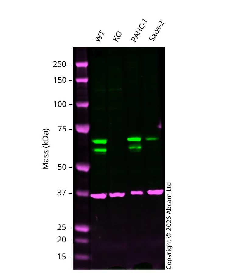 Western blot - Anti-NF-kB p65 antibody [EP2161Y] (AB76311)