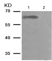 Western blot - Anti-NF-kB p65 (phospho S281) antibody (AB193238)